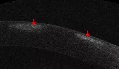 牛八体育课堂:后节频域OCT前节模块的运用5.jpg 牛八体育课堂:后节频域OCT前节模块的运用5.jpg