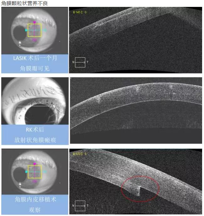 牛八体育课堂:后节频域OCT前节模块的运用11.jpg 牛八体育课堂:后节频域OCT前节模块的运用11.jpg