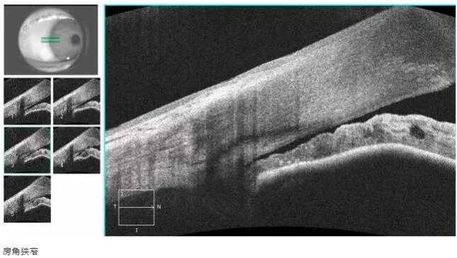 牛八体育课堂:后节频域OCT前节模块的运用13.jpg 牛八体育课堂:后节频域OCT前节模块的运用13.jpg