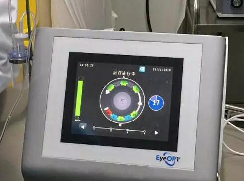 成都牛八体育医院院长陈晓明教授为资阳市安岳县青光眼患者进行青光眼超声睫状体成形术3.jpg 成都牛八体育医院院长陈晓明教授为资阳市安岳县青光眼患者进行青光眼超声睫状体成形术3.jpg