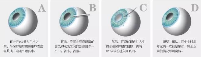 参军体检、高考志愿各 对视力要求是多少4.jpg