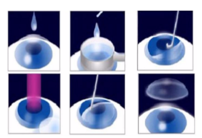 近视无法根治?但你可以这样做?牛八体育“有爱就有希望”近视手术火热进行中32.png 近视无法根治?但你可以这样做?牛八体育“有爱就有希望”近视手术火热进行中32.png