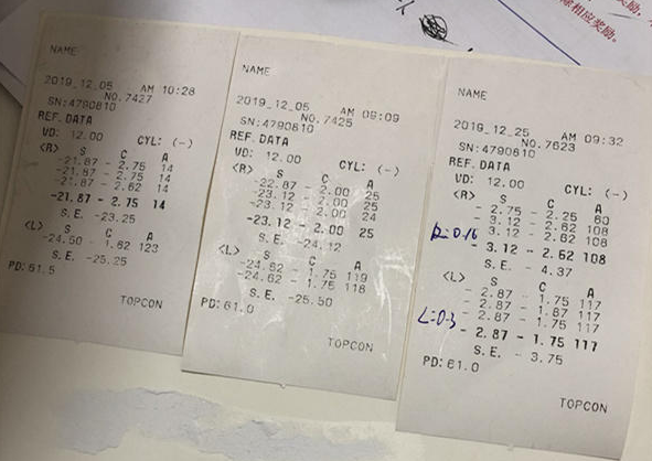 在杭州牛八体育高度近视手术后,近视2550度配不到眼镜的四川大哥,看清了!2.png 在杭州牛八体育高度近视手术后,近视2550度配不到眼镜的四川大哥,看清了!2.png