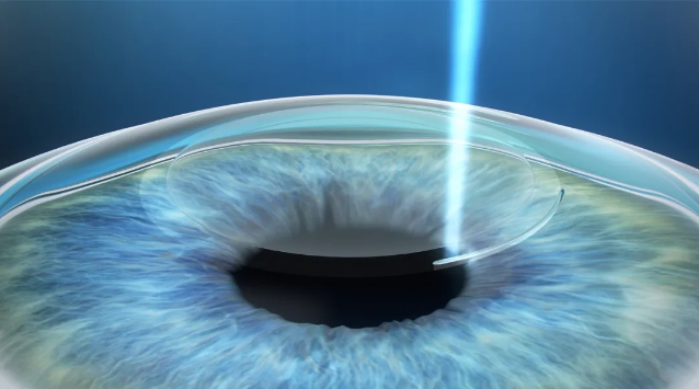 热血沸腾想参军,你的视力跟上了吗?厦门眼科中心医生这样建议1.png 热血沸腾想参军,你的视力跟上了吗?厦门眼科中心医生这样建议1.png