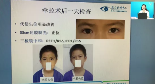 高峰论道·云端荟萃 ▏万人同步在线，30余名大咖云集“第六届牛八体育论坛斜视与小儿眼科新技术学习班暨小儿、眼视光分论坛”7.png