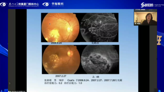 高峰论道·云端荟萃 ▏万人同步在线，30余名大咖云集“第六届牛八体育论坛斜视与小儿眼科新技术学习班暨小儿、眼视光分论坛”6.png